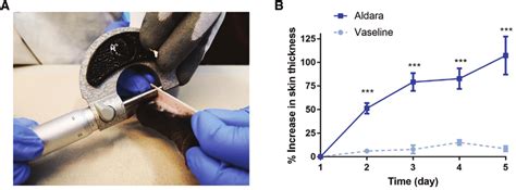 measure skin thickness|how to measure skin thickness.